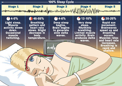 what are sleep stages 1-5
